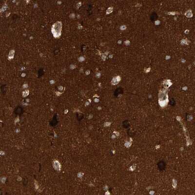 Immunohistochemistry-Paraffin: BAIAP2 Antibody [NBP1-88711]