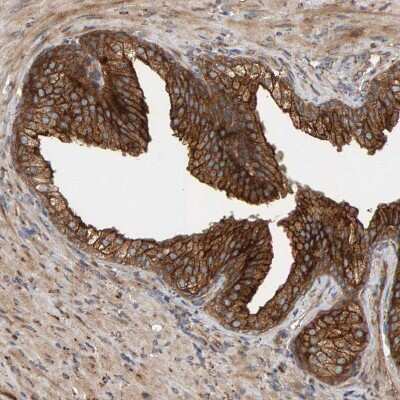 Immunohistochemistry-Paraffin: BAIAP2 Antibody [NBP1-88711]
