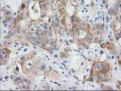 Immunohistochemistry: BAIAP2 Antibody (OTI 1D9) - Azide and BSA Free [NBP2-71603]
