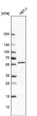 Western Blot: BAIAP2 Antibody [NBP1-88711]