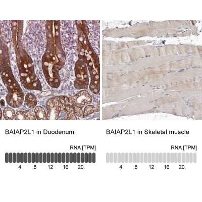 Immunohistochemistry-Paraffin: BAIAP2L1 Antibody [NBP1-85940]