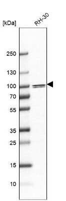 Western Blot: BAL/PARP9 Antibody [NBP2-56376]
