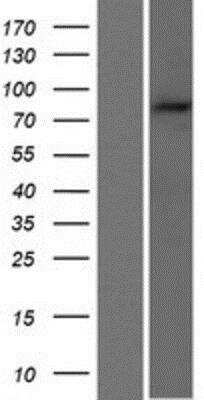 Western Blot: BAL/PARP9 Overexpression Lysate [NBP2-10158]