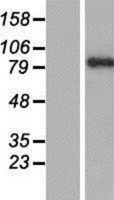 Western Blot: BAL/PARP9 Overexpression Lysate [NBP2-10160]