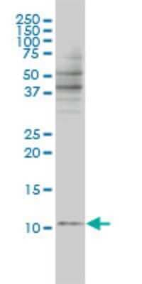 Western Blot: BANF1 Antibody (3F10-4G12) [H00008815-M01]