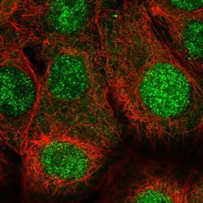 Immunocytochemistry/ Immunofluorescence: BANF1 Antibody [NBP2-38442]