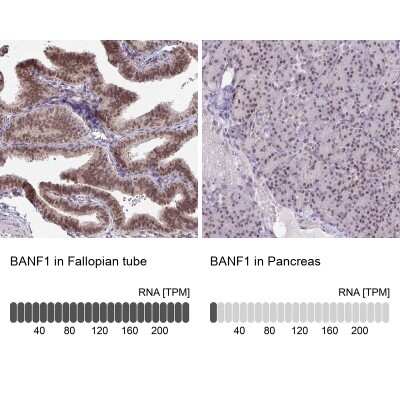 Immunohistochemistry-Paraffin: BANF1 Antibody [NBP2-38442]