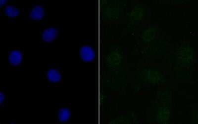 Immunocytochemistry/ Immunofluorescence: BANF1 Antibody (JG40-43) [NBP2-76978]