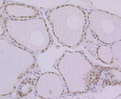 Immunohistochemistry: BANF1 Antibody (JG40-43) [NBP2-76978]