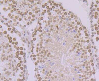 Immunohistochemistry: BANF1 Antibody (JG40-43) [NBP2-76978]
