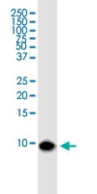 Western Blot: BANF1 Antibody (M2) [H00008815-M07]