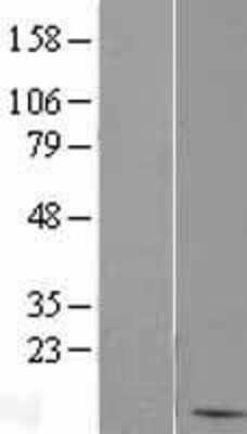 Western Blot: BANF1 Overexpression Lysate [NBP2-09702]