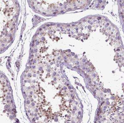 Immunohistochemistry-Paraffin: BANF2 Antibody [NBP1-88718]