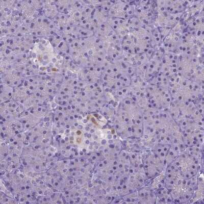 Immunohistochemistry-Paraffin: BANF2 Antibody [NBP1-88718]