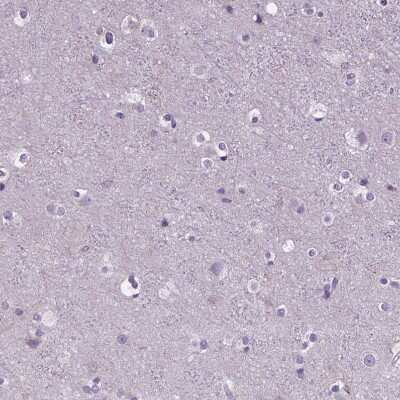 Immunohistochemistry-Paraffin: BANF2 Antibody [NBP1-88718]