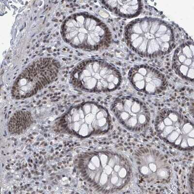 Immunohistochemistry-Paraffin: BANP Antibody [NBP2-14346]