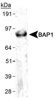 Western Blot: BAP1 Antibody (1G8) [NB110-60521]