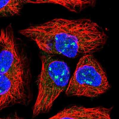 Immunocytochemistry/ Immunofluorescence: BAP28 Antibody [NBP2-14087]