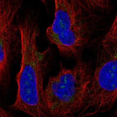 Immunocytochemistry/ Immunofluorescence: BAP28 Antibody [NBP2-56942]