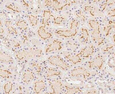Immunohistochemistry-Paraffin: BAP28 Antibody [NBP3-12652]