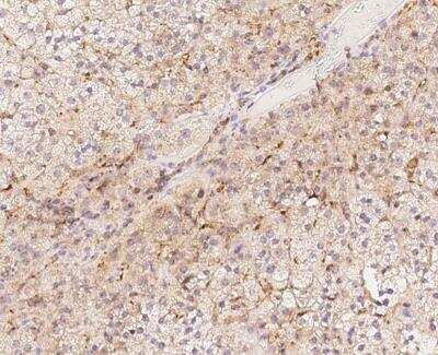 Immunohistochemistry-Paraffin: BAP28 Antibody [NBP3-12652]