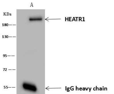 Immunoprecipitation: BAP28 Antibody [NBP3-12652]