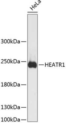 Western Blot: BAP28 AntibodyAzide and BSA Free [NBP2-92105]