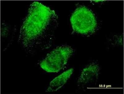 Immunocytochemistry/ Immunofluorescence: BAP29 Antibody (4B10) [H00055973-M07]