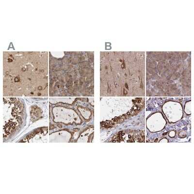Immunohistochemistry-Paraffin: BAP29 Antibody [NBP1-90009]
