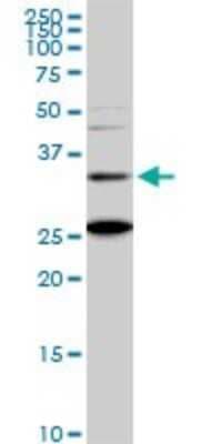 Western Blot: BARHL1 Antibody (2B11) [H00056751-M01]