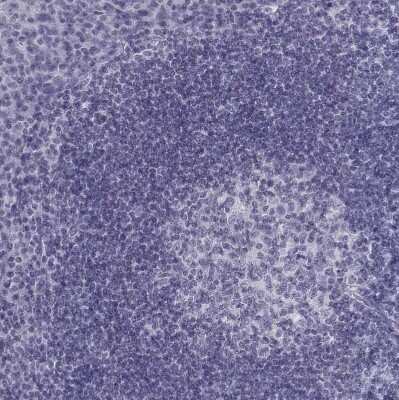 Immunohistochemistry-Paraffin: BARHL1 Antibody [NBP1-86513]