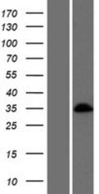 Western Blot: BARHL1 Overexpression Lysate [NBP2-06690]