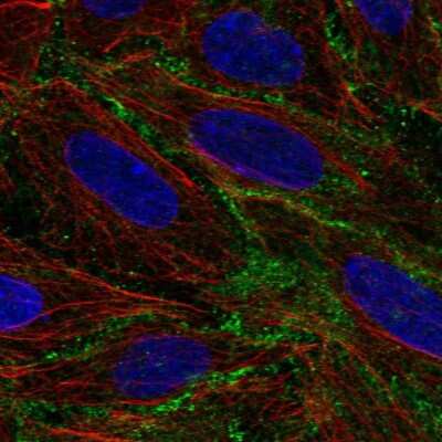Immunocytochemistry/ Immunofluorescence: BASP1 Antibody [NBP2-14347]