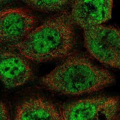 Immunocytochemistry/ Immunofluorescence: BAT3/BAG6 Antibody [NBP2-38693]