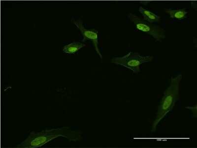 Immunocytochemistry/ Immunofluorescence: BATF3 Antibody (3H1) [H00055509-M04]