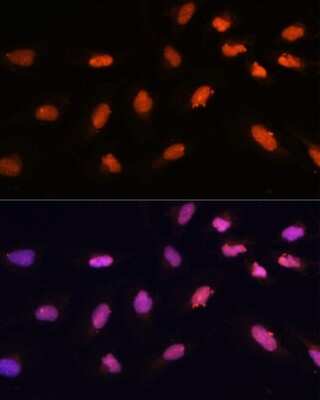 Immunocytochemistry/ Immunofluorescence: BAZ2A Antibody - Azide and BSA Free [NBP2-91988]