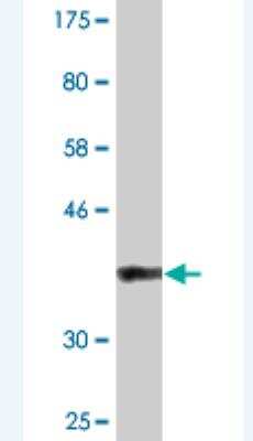 Western Blot: BAZ2B Antibody (2D10) [H00029994-M07]