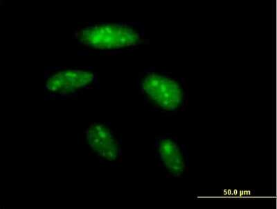 Immunocytochemistry/ Immunofluorescence: BAZ2B Antibody [H00029994-B01P]