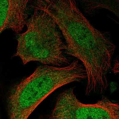 Immunocytochemistry/ Immunofluorescence: BAZ2B Antibody [NBP2-57156]