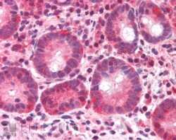 Immunohistochemistry-Paraffin: BAZ2B Antibody [NB100-1155]