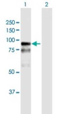Western Blot: BAZ2B Antibody [H00029994-B01P]