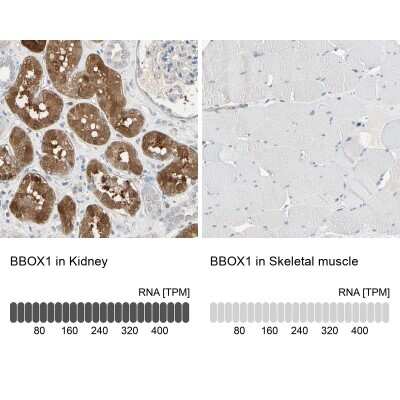 Immunohistochemistry-Paraffin: BBOX1 Antibody [NBP1-88695]