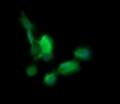 Immunocytochemistry/ Immunofluorescence: BBOX1 Antibody (OTI4F9) - Azide and BSA Free [NBP2-71372]