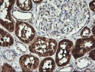 Immunohistochemistry: BBOX1 Antibody (OTI4F9) - Azide and BSA Free [NBP2-71372]