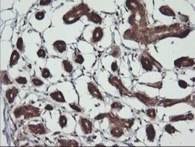 Immunohistochemistry: BBOX1 Antibody (OTI4F9) [NBP2-45548]