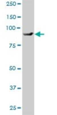 Western Blot: BBS12 Antibody [H00166379-B01P]