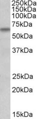 Western Blot: BBS4 Antibody [NBP1-68872]