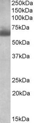 Western Blot: BBS4 Antibody [NBP1-68873]