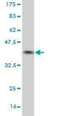 Western Blot: BBS7 Antibody (2H6) [H00055212-M01]