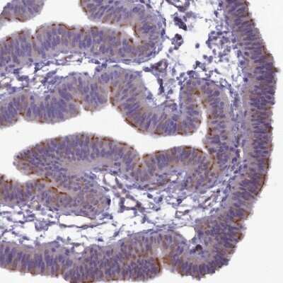 Immunohistochemistry-Paraffin: BBS7 Antibody [NBP1-88690]